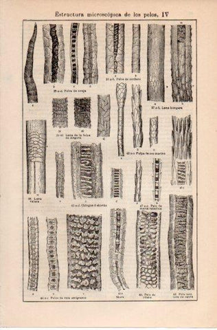 LAMINA V39776: Estructura microscopica de los pelos IV