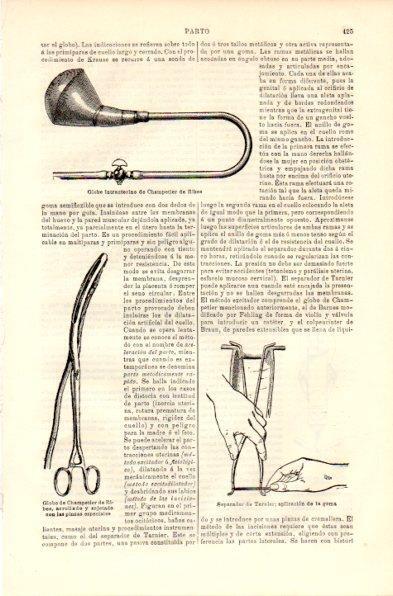LAMINA V42362: Globo intrauterino de Champetier de Ribes