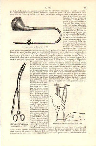 LAMINA V42362: Globo intrauterino de Champetier de Ribes