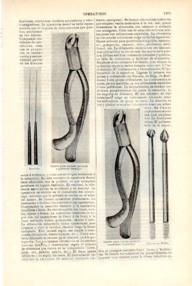 LAMINA V50568: Gatillo para operar