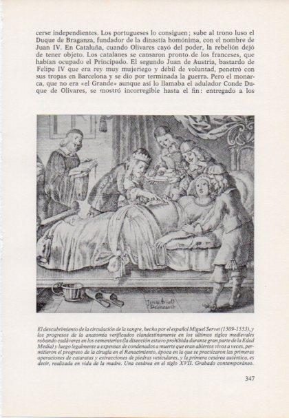 LAMINA V15484: Una cesarea en el siglo XVII grabado