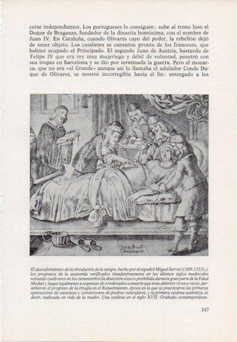 LAMINA V15484: Una cesarea en el siglo XVII grabado