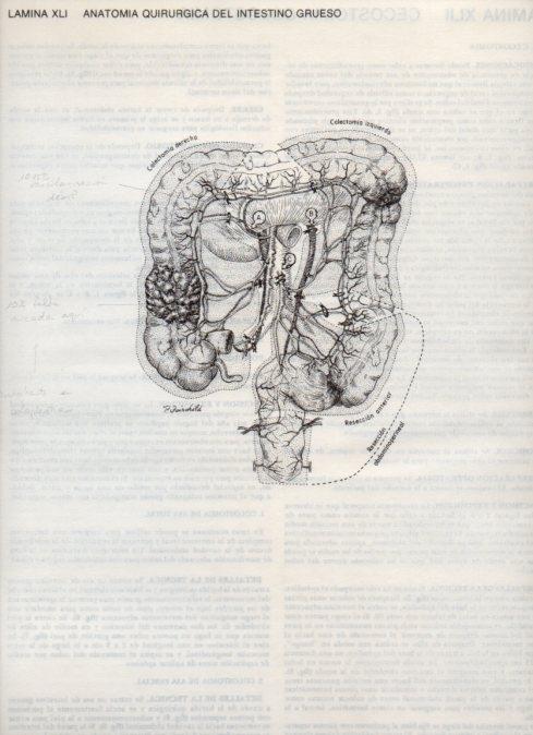 LAMINA V20102: Anatomia quirurgica del intestino grueso