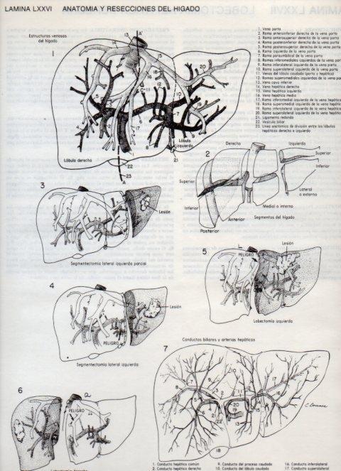 LAMINA V20137: Anatomia y resecciones del higado
