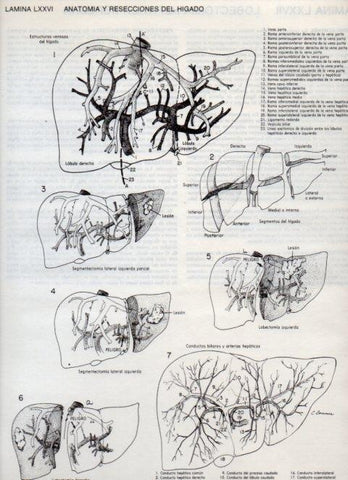 LAMINA V20137: Anatomia y resecciones del higado