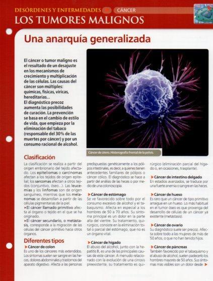LAMINA V28627: Los tumores malignos