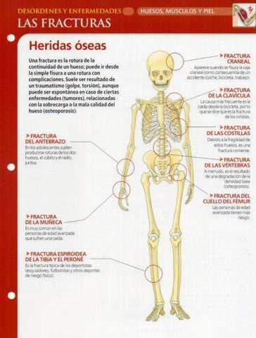 LAMINA V28621: Las fracturas