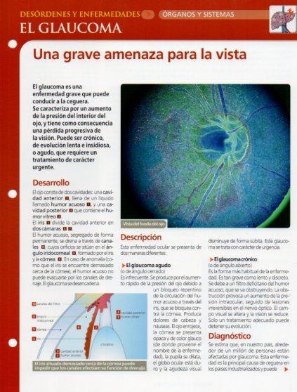 LAMINA V28618: El glaucoma