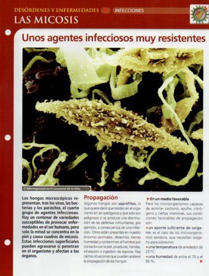 LAMINA V28650: Las micosis