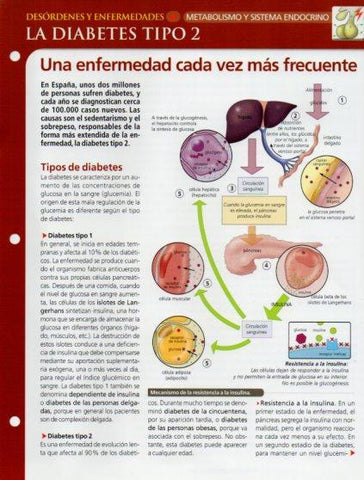 LAMINA V28652: La diabetes tipo 2