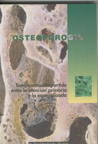 Osteoporosis: tratamiento compartido entre la atencion primaria y la especializada