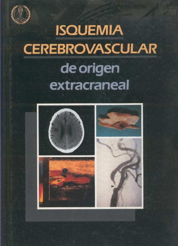 Isquemia cerebrovascular de origen extracraneal