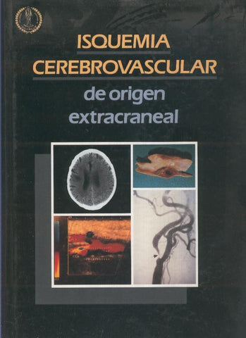 Isquemia cerebrovascular de origen extracraneal