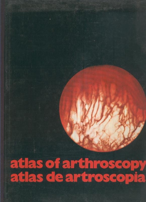 Atlas of arthroscopy - Atlas de Artroscopia