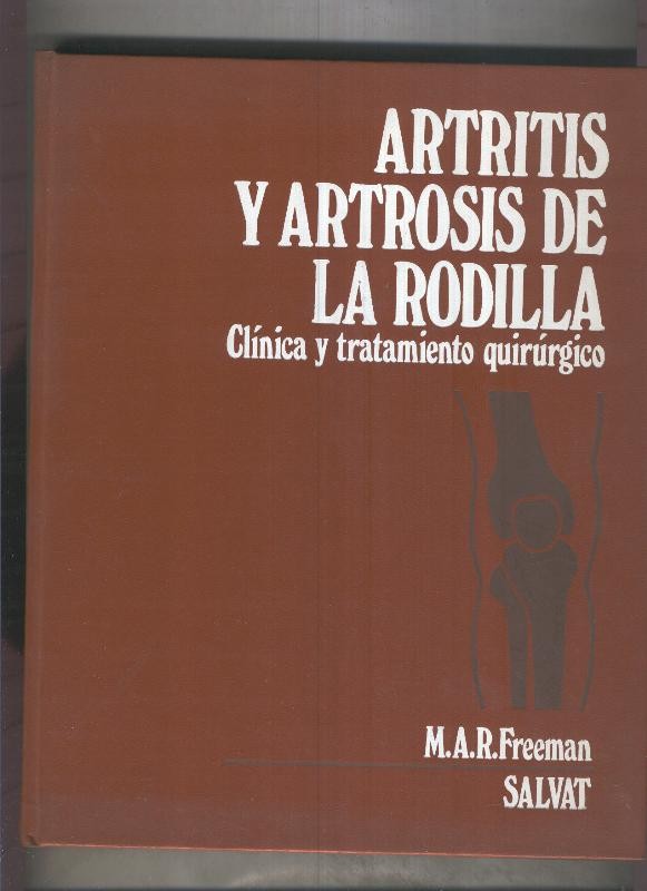 Artritis y artrosis de la rodilla, clinica y tratamiento quirurgico