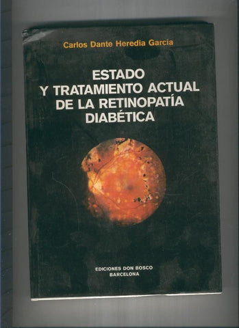Estado y tratamiento actual de la Retinopatia Diabetica