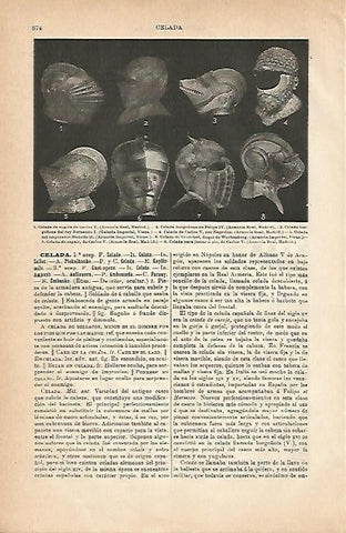 LAMINA ESPASA 2947: Tipos de celada