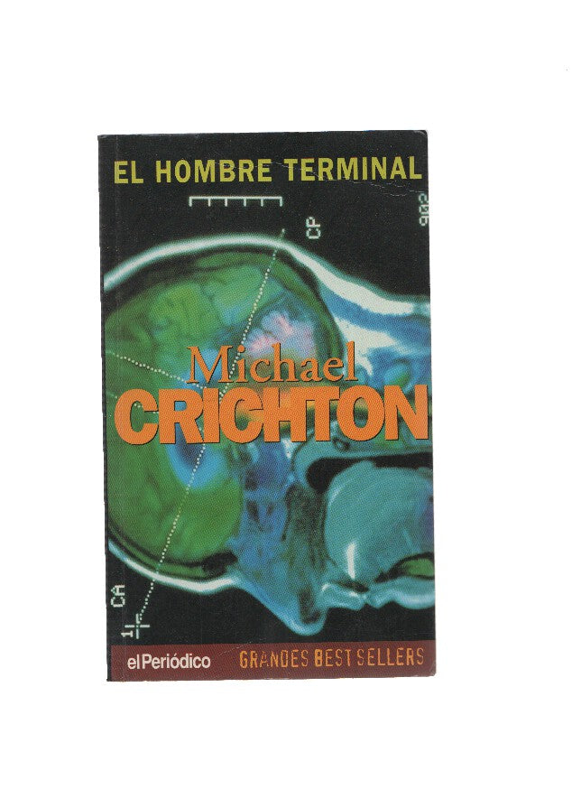 El hombre terminal