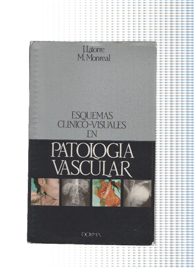 Esquemas clinico visuales en Patologia Vascular