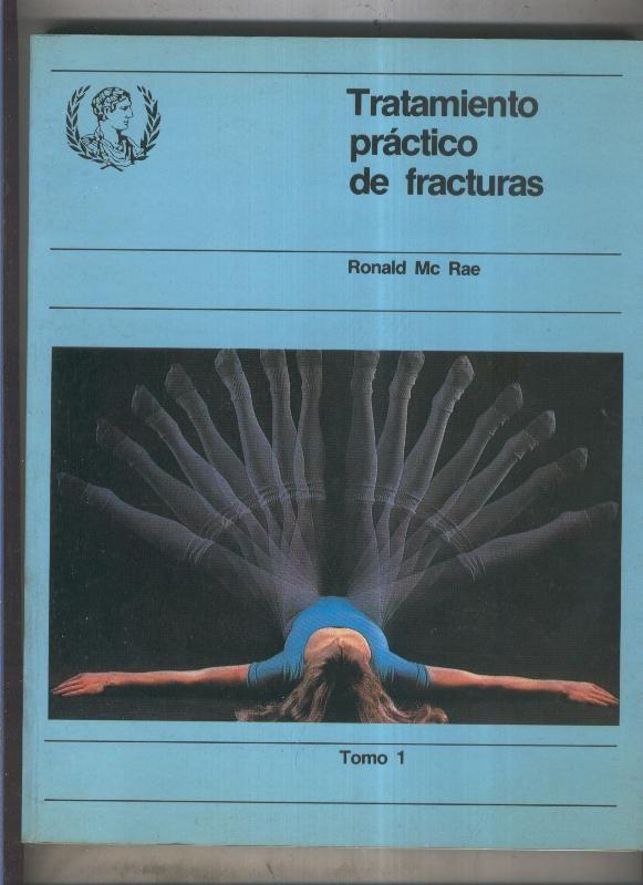 Tratamiento practico de fracturas