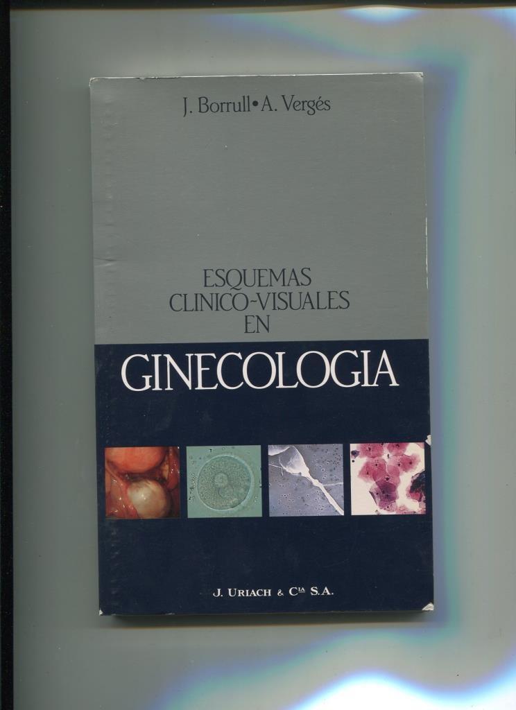 Esquemas clinico visuales en Ginecologia