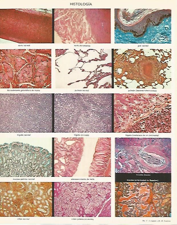 LAMINA LAROUSSE 70117: Histologia