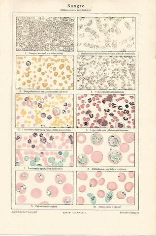 LAMINA ESPASA 18421: Alteraciones patologicas de la sangre