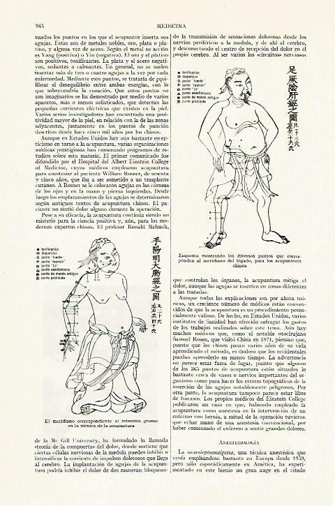 LAMINA ESPASA 13465: Dibujos de acupuntura
