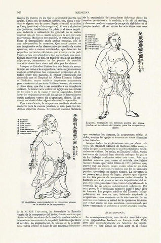 LAMINA ESPASA 13465: Dibujos de acupuntura