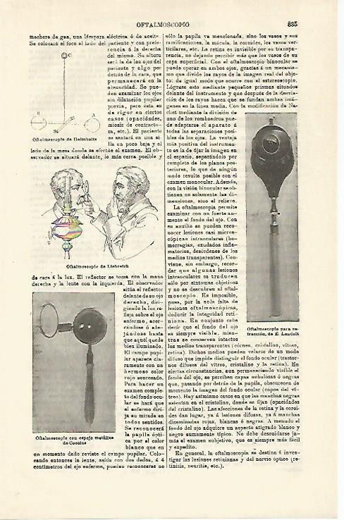LAMINA ESPASA 21335: Tipos de oftalmoscopios