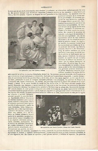 LAMINA ESPASA 26067: La operacionpor Adams