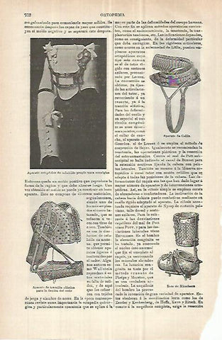 LAMINA ESPASA 32923: Aparatos ortopedicos