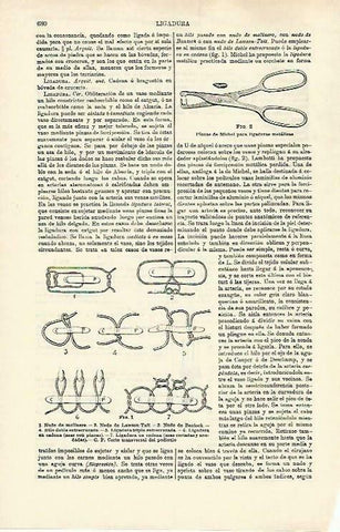 LAMINA ESPASA 33267: Pinzas de Michel y nudos