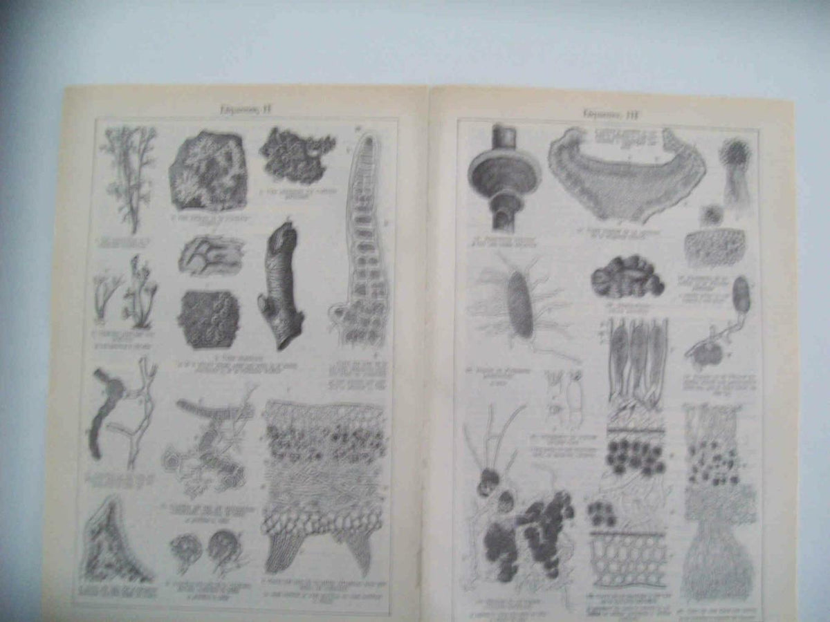 LAMINA ESPASA 33334: Tipos de liquenes