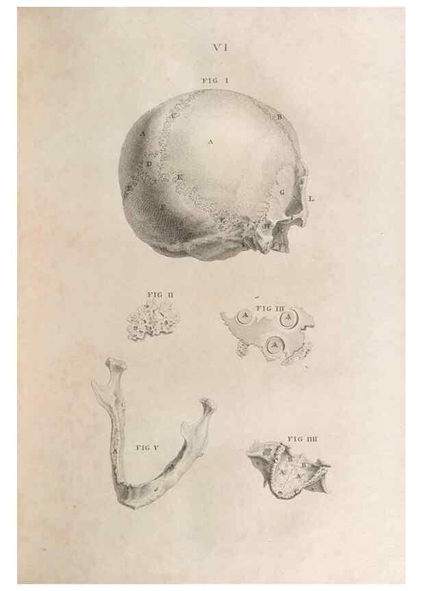 Reproducción/Reproduction 48832428873: Osteographia, or the Anatomy of the Bones.. London,1733.. 