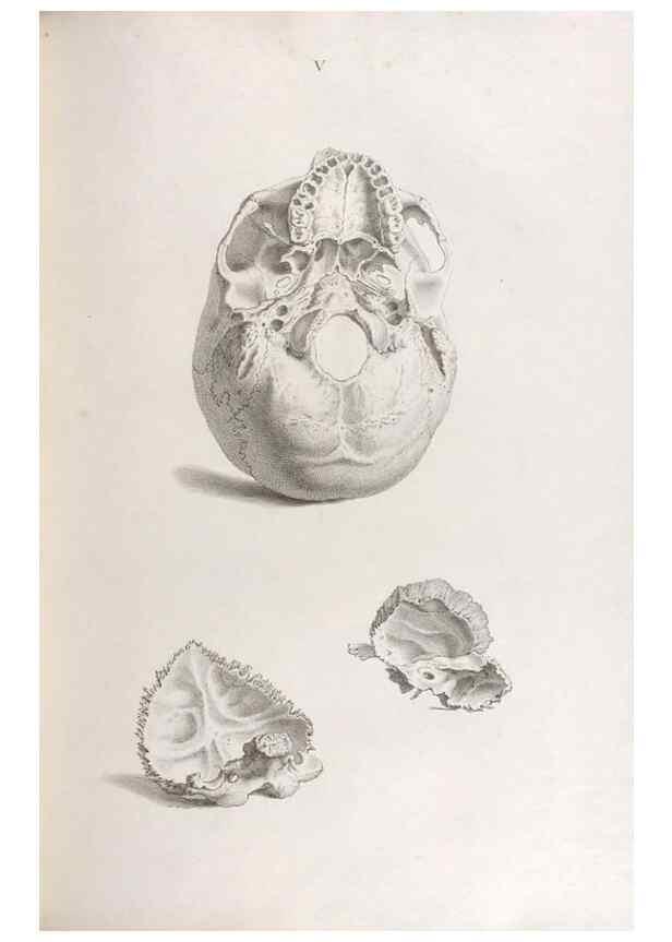 Reproducción/Reproduction 48832449188: Osteographia, or the Anatomy of the Bones.. London,1733.. 