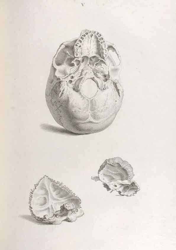 Reproducción/Reproduction 48832449188: Osteographia, or the Anatomy of the Bones.. London,1733.. 