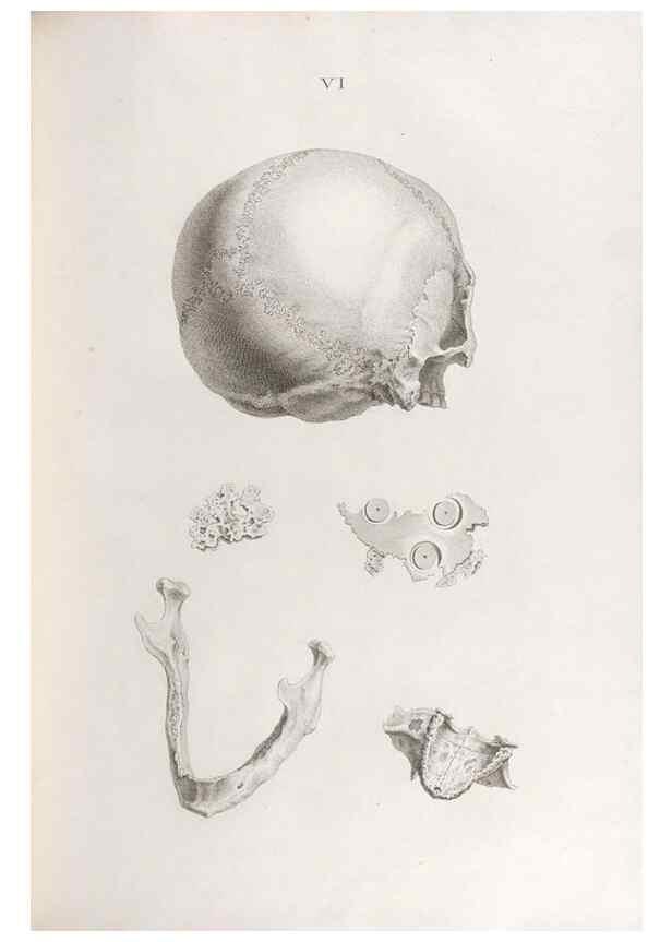 Reproducción/Reproduction 48832815561: Osteographia, or the Anatomy of the Bones.. London,1733.. 