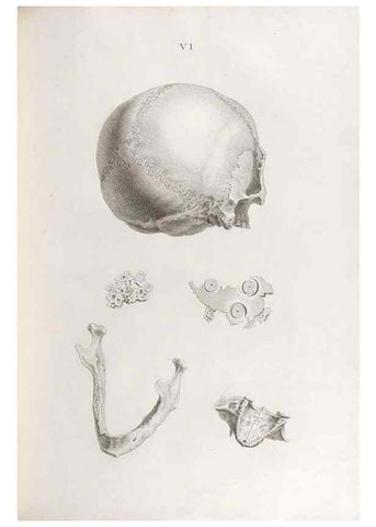 Reproducción/Reproduction 48832815561: Osteographia, or the Anatomy of the Bones.. London,1733.. 