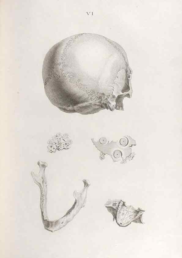 Reproducción/Reproduction 48832815561: Osteographia, or the Anatomy of the Bones.. London,1733.. 