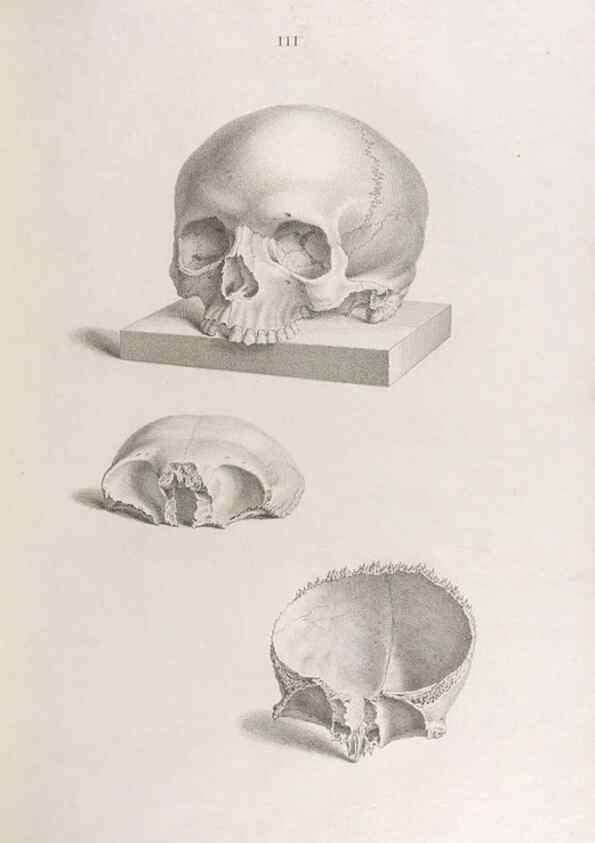 Reproducción/Reproduction 48832814516: Osteographia, or the Anatomy of the Bones.. London,1733.. 