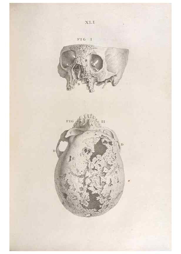 Reproducción/Reproduction 48832807791: Osteographia, or the Anatomy of the Bones.. London,1733.. 