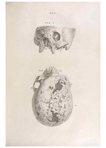 Reproducción/Reproduction 48832807791: Osteographia, or the Anatomy of the Bones.. London,1733.. 