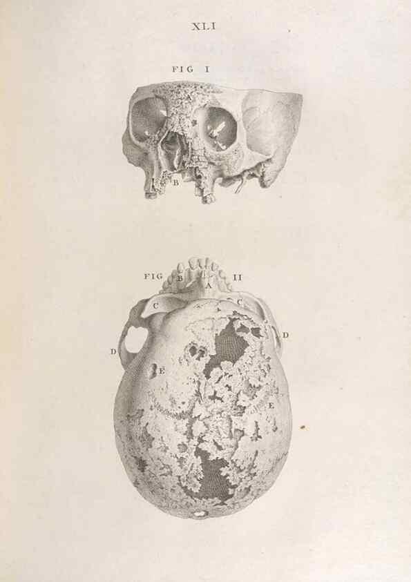 Reproducción/Reproduction 48832807791: Osteographia, or the Anatomy of the Bones.. London,1733.. 
