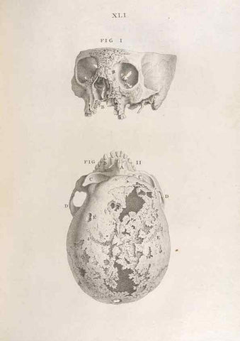 Reproducción/Reproduction 48832807791: Osteographia, or the Anatomy of the Bones.. London,1733.. 