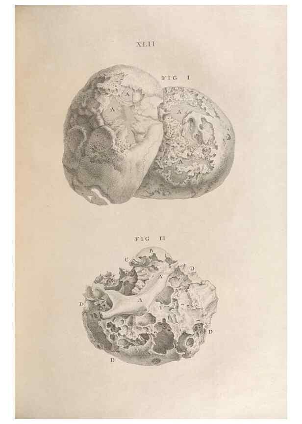 Reproducción/Reproduction 48832808121: Osteographia, or the Anatomy of the Bones.. London,1733.. 