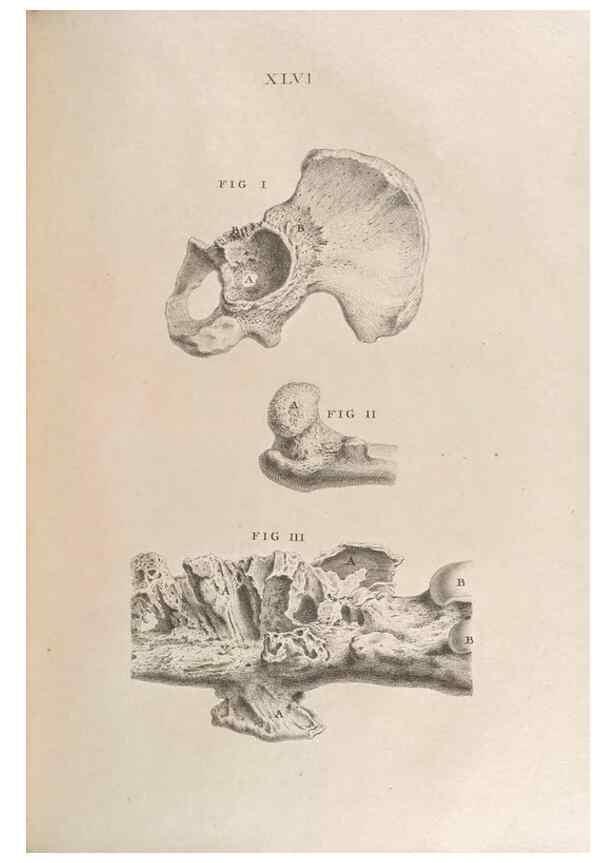 Reproducción/Reproduction 48832443568: Osteographia, or the Anatomy of the Bones.. London,1733.. 