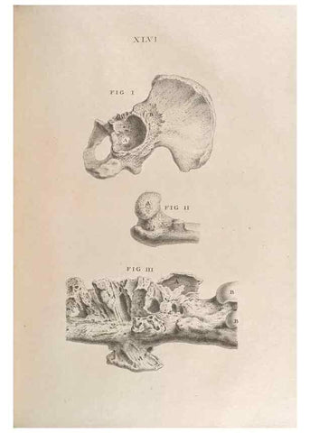 Reproducción/Reproduction 48832443568: Osteographia, or the Anatomy of the Bones.. London,1733.. 