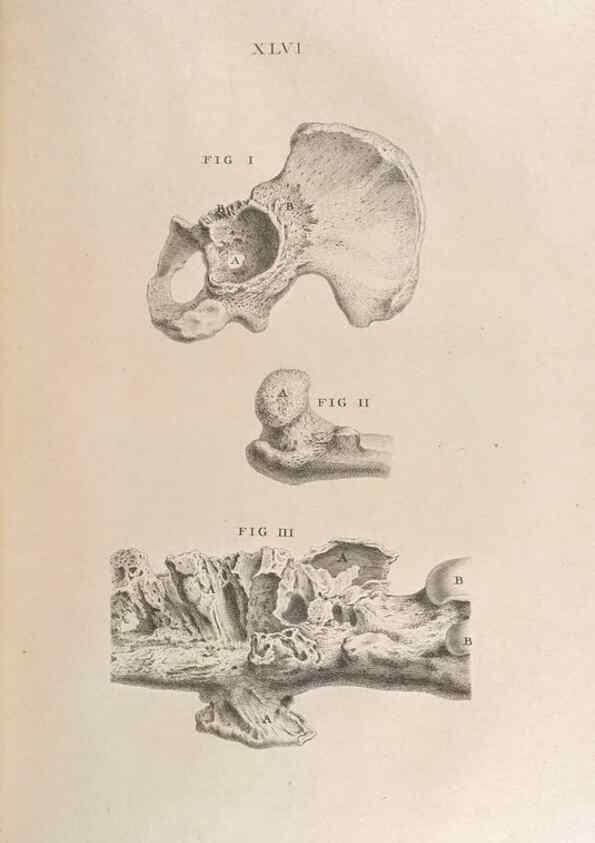 Reproducción/Reproduction 48832443568: Osteographia, or the Anatomy of the Bones.. London,1733.. 