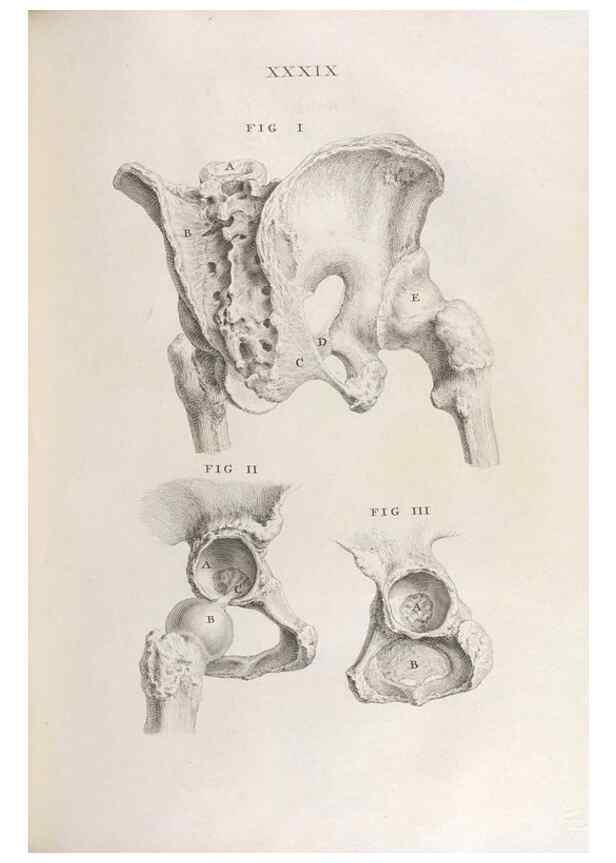 Reproducción/Reproduction 48832441118: Osteographia, or the Anatomy of the Bones.. London,1733.. 